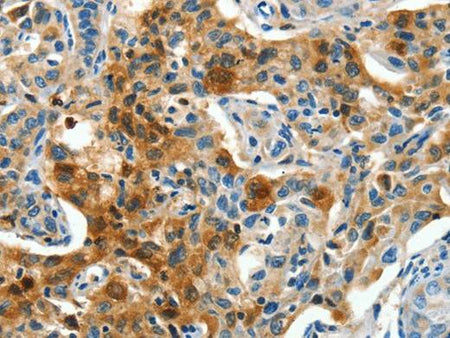 COG1 Polyclonal Antibody