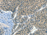 CRLF2 Polyclonal Antibody