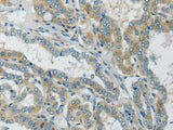 Connexin-45 Polyclonal Antibody