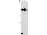 PLA2G4B Polyclonal Antibody
