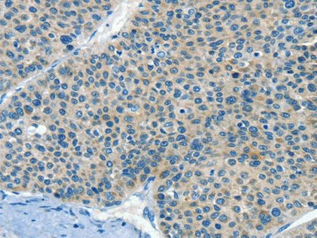 HID1 Polyclonal Antibody