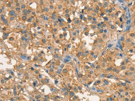 CRELD1 Polyclonal Antibody Store at -20°C Host Rabbit
