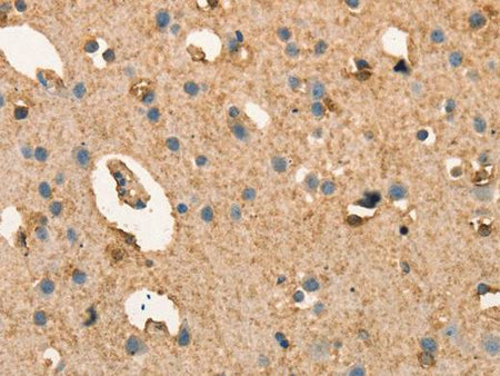 CRELD1 Polyclonal Antibody Store at -20°C Host Rabbit