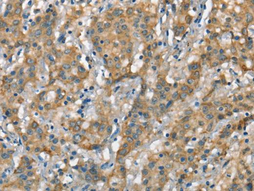 CSMD1 Polyclonal Antibody