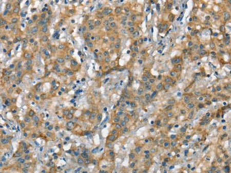 CSMD1 Polyclonal Antibody