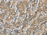 CSMD1 Polyclonal Antibody