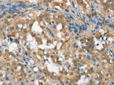 CSMD1 Polyclonal Antibody