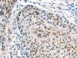 CTBP2 Polyclonal Antibody