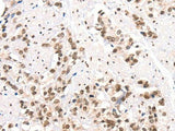 CTBP2 Polyclonal Antibody