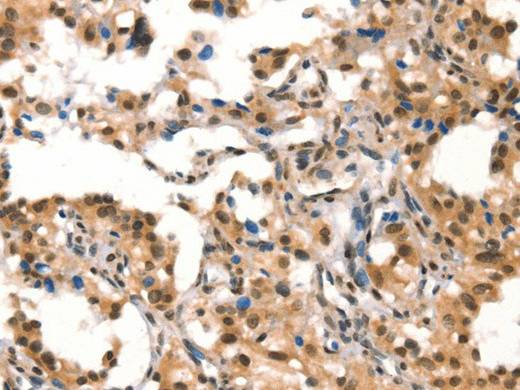 CUL4B Polyclonal Antibody Store at -20°C Host Rabbit