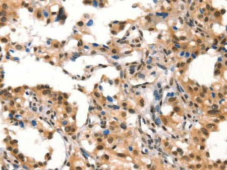 CUL4B Polyclonal Antibody Store at -20°C Host Rabbit