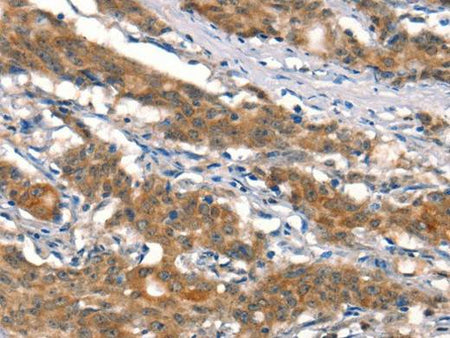 CUL4B Polyclonal Antibody Store at -20°C Host Rabbit
