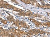 CUL4B Polyclonal Antibody Store at -20°C Host Rabbit