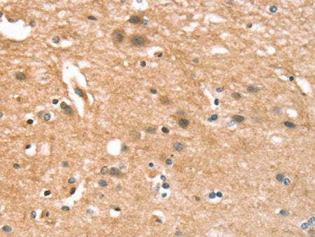 CYLD Polyclonal Antibody