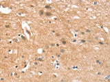 CYLD Polyclonal Antibody