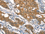 CYLD Polyclonal Antibody