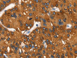 Cytochrome b Polyclonal Antibody