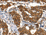 Cytochrome b Polyclonal Antibody