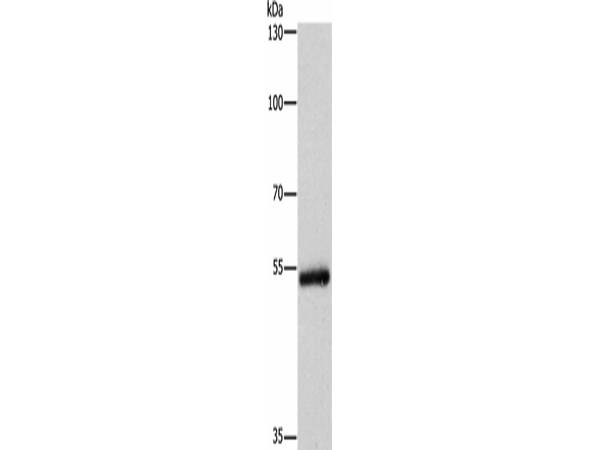 CYP2B6 Polyclonal Antibody Store at -20°C