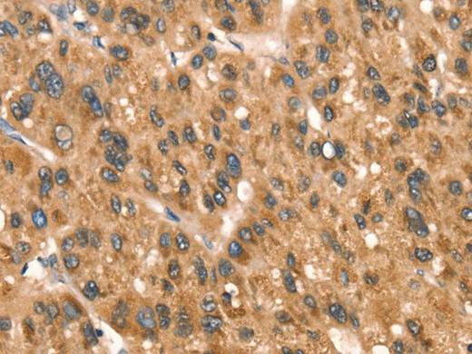 DAP Polyclonal Antibody Store at -20°C Host Rabbit