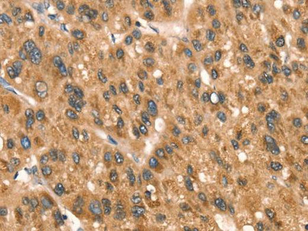 DAP Polyclonal Antibody Store at -20°C Host Rabbit