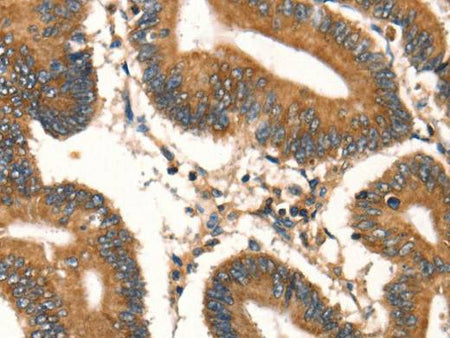 DAP Polyclonal Antibody Store at -20°C Host Rabbit