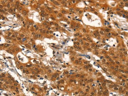 DEAF1 Polyclonal Antibody