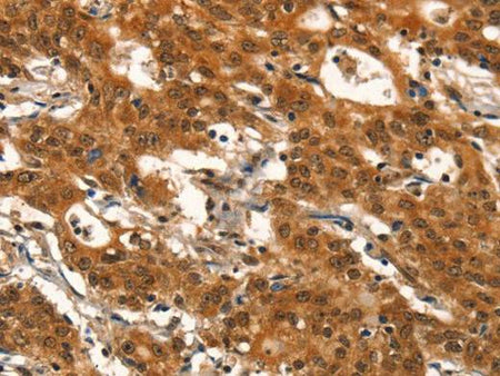 DEAF1 Polyclonal Antibody