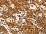DEAF1 Polyclonal Antibody