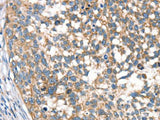 DECR1 Polyclonal Antibody