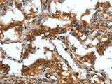 DEFA4 Polyclonal Antibody