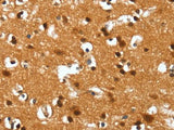 DEFA4 Polyclonal Antibody