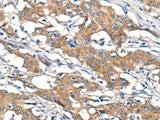 DSC1 Polyclonal Antibody