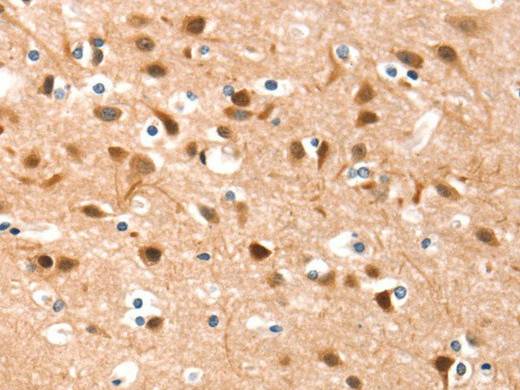 DSC1 Polyclonal Antibody