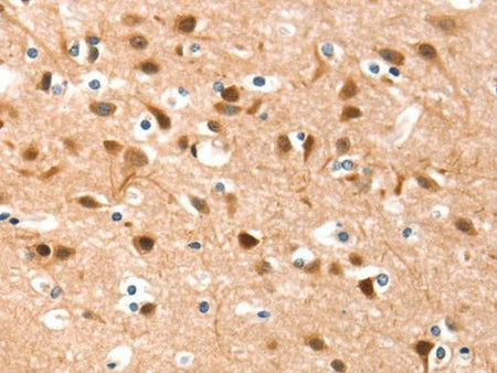 DSC1 Polyclonal Antibody