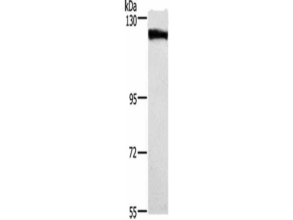 DSG1 Polyclonal Antibody Store at -20°C
