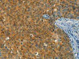 DIRAS1 Polyclonal Antibody