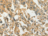 DIRAS1 Polyclonal Antibody