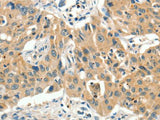 SLC11A2 Polyclonal Antibody