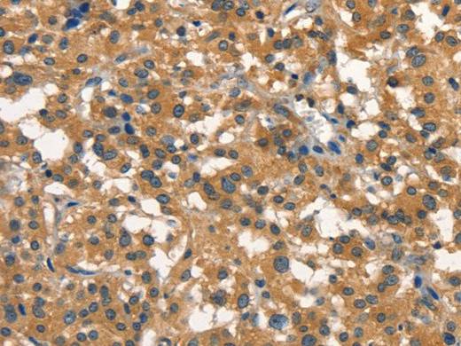 DNM2 Polyclonal Antibody Store at -20°C Host Rabbit