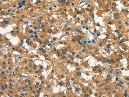 DNM2 Polyclonal Antibody Store at -20°C Host Rabbit