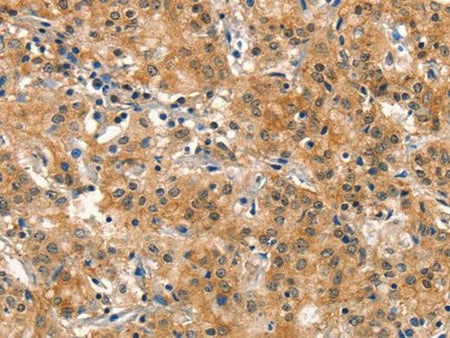 DNM2 Polyclonal Antibody Store at -20°C Host Rabbit