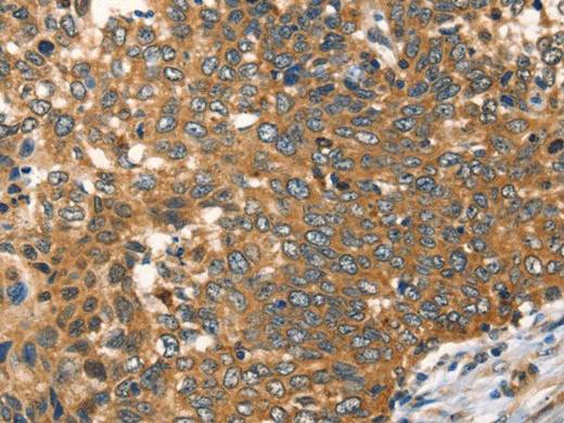 AGO1 Polyclonal Antibody
