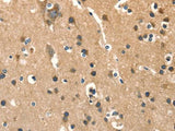 AGO1 Polyclonal Antibody