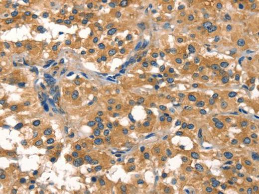 EIF4G1 Polyclonal Antibody Store at -20°C