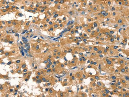 EIF4G1 Polyclonal Antibody Store at -20°C