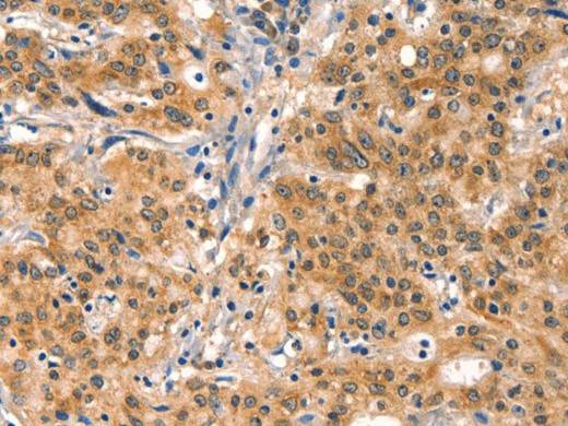 EIF4G1 Polyclonal Antibody Store at -20°C