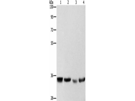 AIMP1 Polyclonal Antibody Store at -20°C Host Rabbit