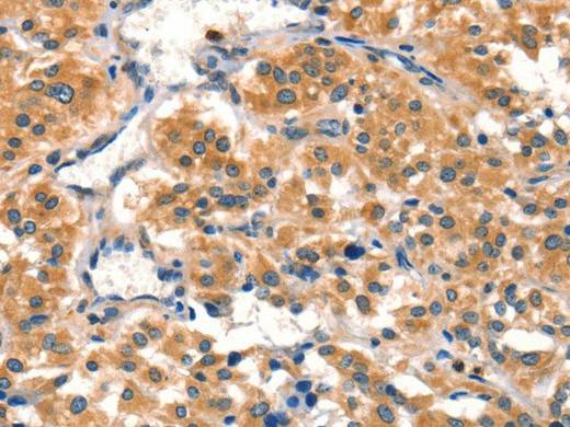 AIMP1 Polyclonal Antibody Store at -20°C Host Rabbit