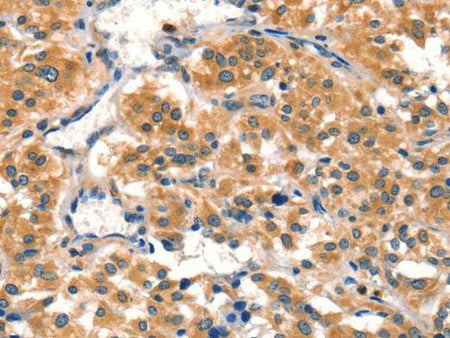 AIMP1 Polyclonal Antibody Store at -20°C Host Rabbit